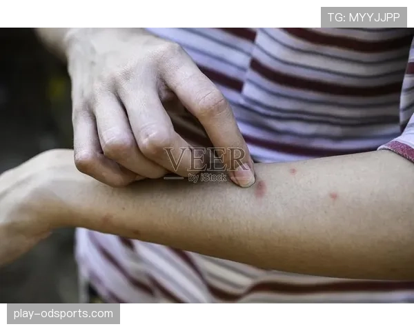 手臂在“自然位置”就不算手球？规则如何界定这个模糊地带